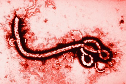 日本上陸も秒読み エボラウイルス米国人看護師感染の意味 Wedge Infinity ウェッジ